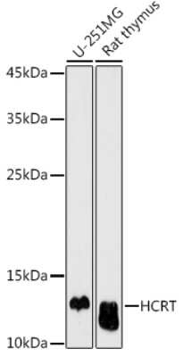 Western Blot: Orexin AntibodyAzide and BSA Free [NBP2-93319]